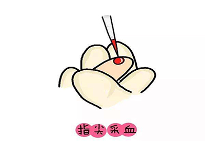 儿童麻豆传媒三级片微量元素的检测项目有哪些